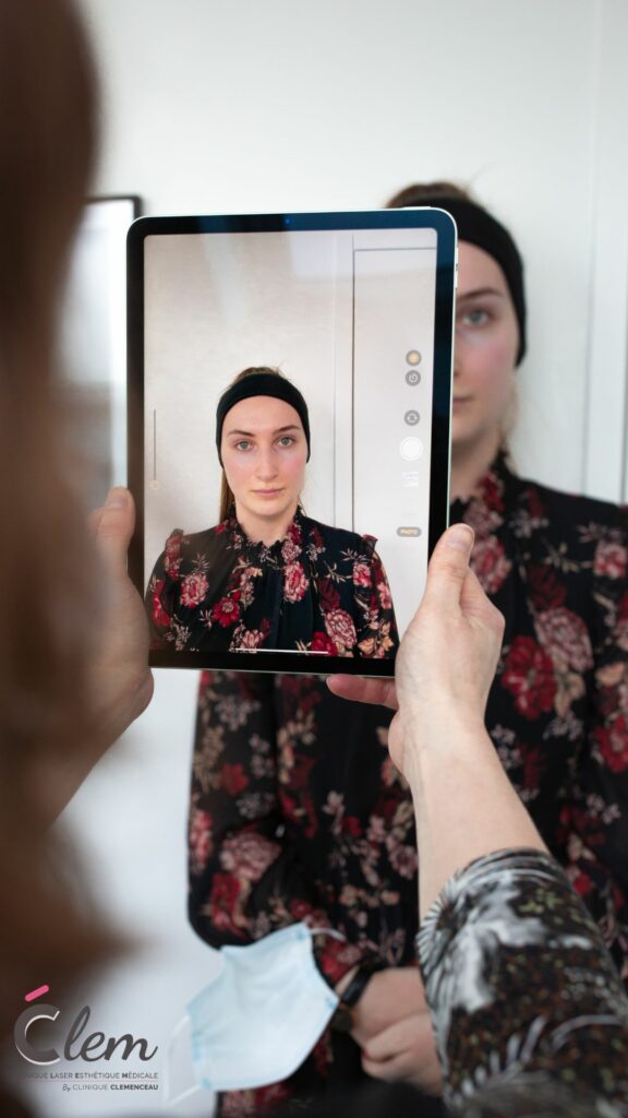 Première consultation de médecine esthétique à Lille ou Arras