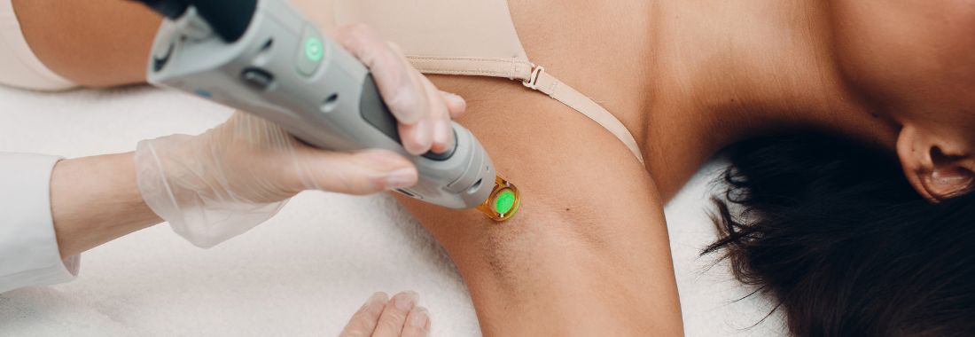 epilation-laser-definitive-peau-noire-clem