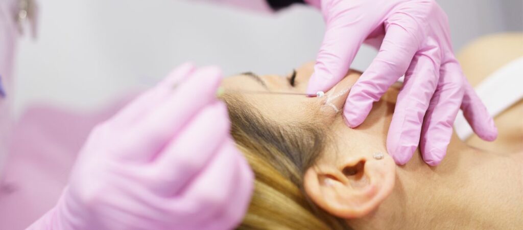 Fils tenseurs résorbables à la clinique CLEM de Lille ou Arras