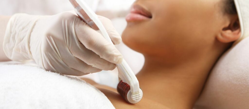 Le Mésolift microneedling à la clinique CLEM de Lille