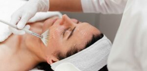 le peeling est-il la solution après l'été ?